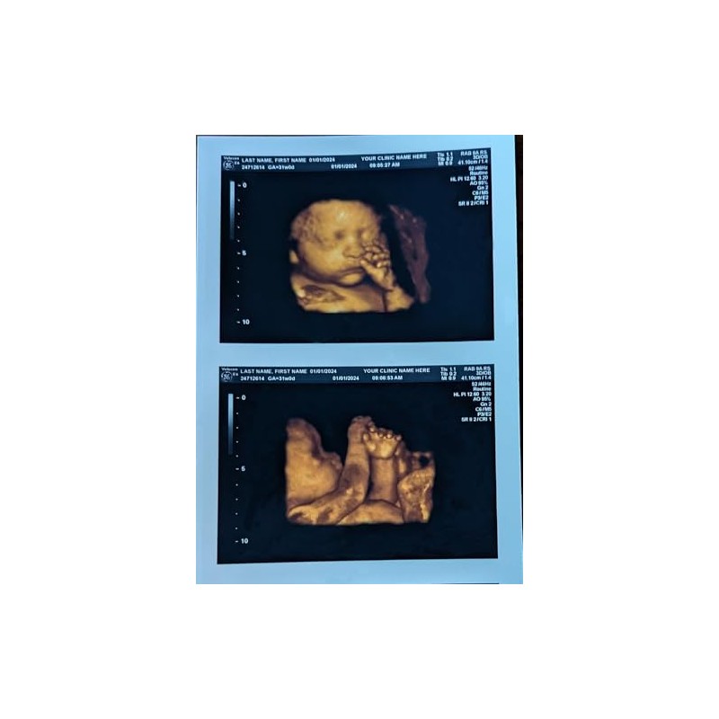 Prank 3D COLOR Customized Fake Ultrasound Strip of 2 Photos