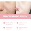 Hidratante Suave 30 Ml