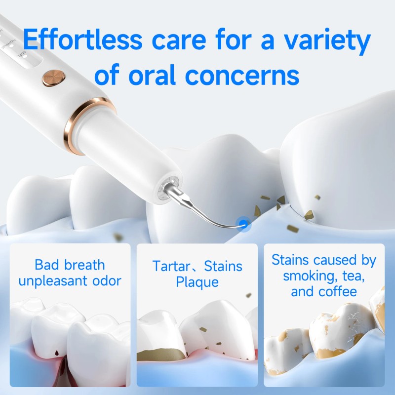 Dental Cleaning Kit Tartar Plaque Remover for Teeth with LED