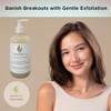 Clear Skin AHA/BHA Exfoliating Cleanser (8 oz) - Gentle Acne