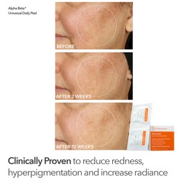 Dr. Dennis Gross Plump & Smooth Limited Edition Kit – DermInfusions™ Blur + Repair Cream (0.67 oz) + 5 Alpha Beta® Universal Daily Peels | Hydrate, Exfoliate & Smooth Fine Lines