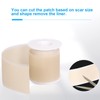 Adhesive Silicone Scar Patch Safety Mild Fade Scar Scar Reduction
