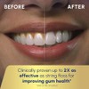 Waterpik Irrigador Dental - Aquarius Professional, WP-660 Blanco