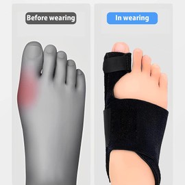Bunion Corrector-Toe Spacers,Big Toe Separator,Toe Spacers Straighteners and Exercise Strap for Hallux Valgus Correction for Women and Men-Effective & Comfortable Toe Separators to Correct Bunions