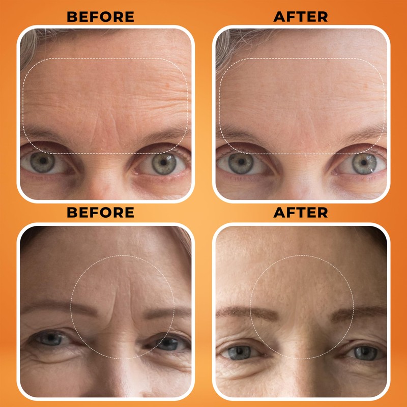 BOTANIFIQUE Deep Wrinkle Filler for Face – Collagen-Infused Cream with