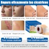 parches de silicona para cicatrices,cinta de silicona para cicatrices, elimina