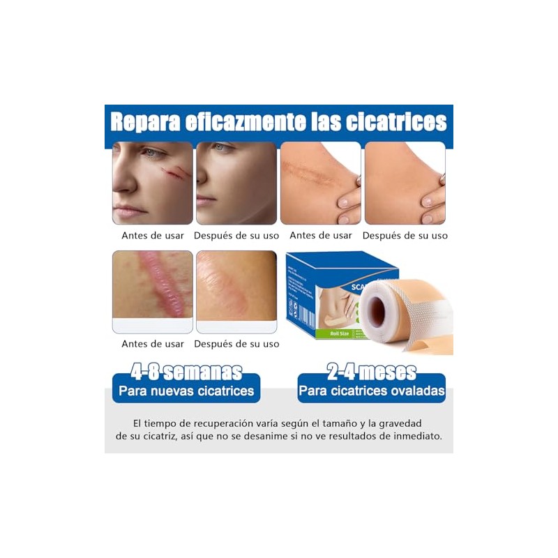 parches de silicona para cicatrices,cinta de silicona para cicatrices, elimina