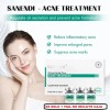 Sanendi Vial Tratamiento Para Acné Piel Grasa Dermapen 5ml