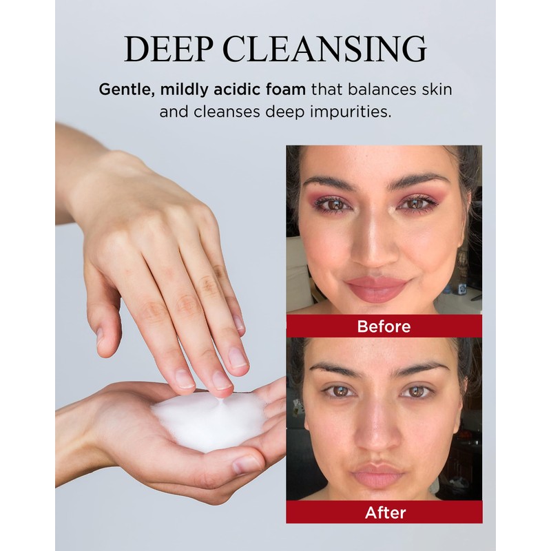 Danahan Bonyongo Red Ginseng Vinegar Foam Cleanser – Gentle Deep