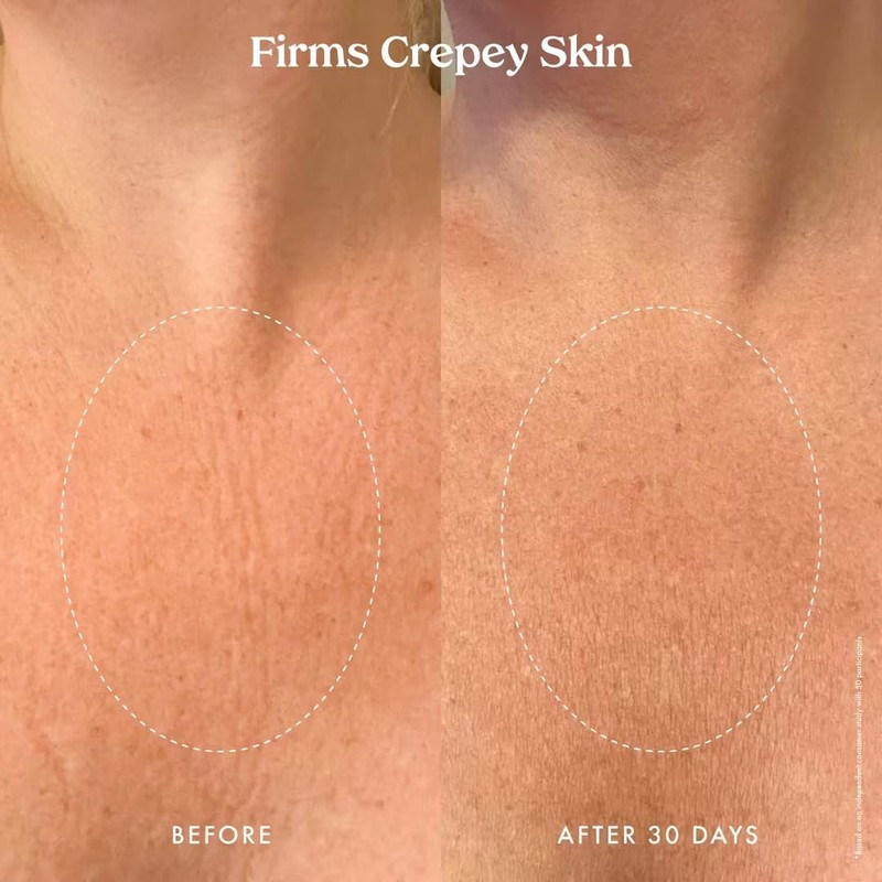 Kopari Ultra Renewal Retinol Body Cream, Infused with Acai &