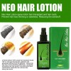 Neo Hair 3x Neo Hair Lotion Green Wealth Hair Loss