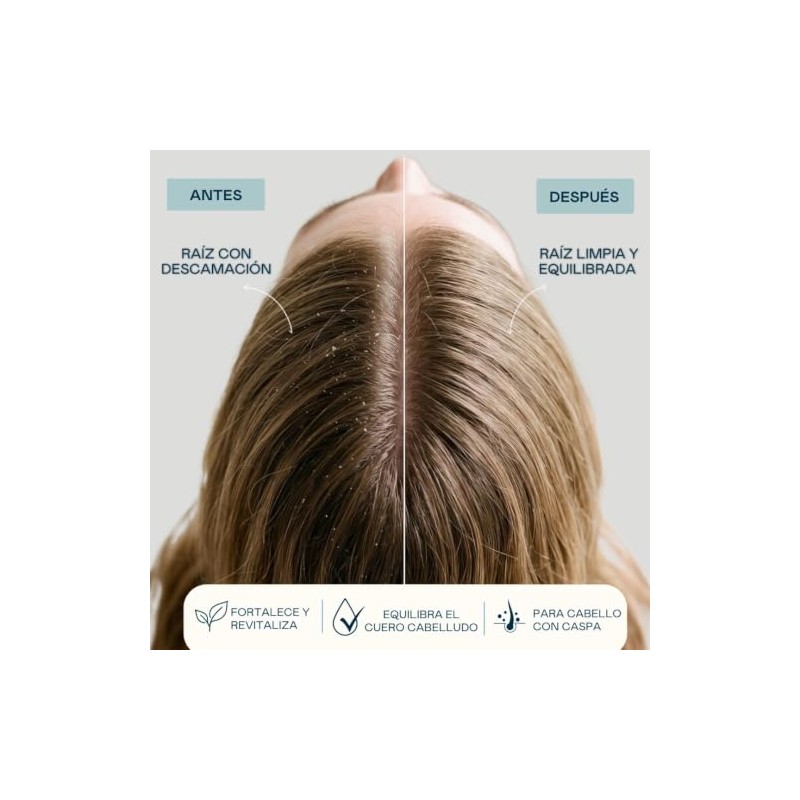 VALQUER Shampoo Anticaspa Zero Sin Sulfatos 400 ml