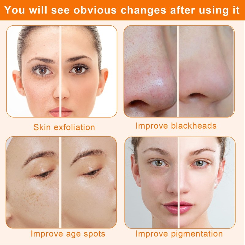 Diamond Microdermabrasion Machine,Mcwdoit 3 in 1 Dermabrasion Facial Machine for