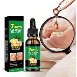 Ginger Nail, Tratamiento de Uñas con Jengibre, Soporte para Uñas, Cuidado de Uñas, Suero para El Crecimiento de Uñas con Jengibre, Aceite Fortalecedor para Uñas