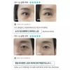 Shard 샤르드 아이백 리프트 1100샷 아이패치 세트(4개입) 3개(+추가 단품 2개)