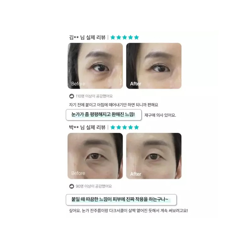 Shard 샤르드 아이백 리프트 1100샷 아이패치 세트(4개입) 3개(+추가 단품 2개)