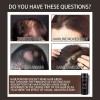Polvo De Fibra Capilar Negro Cubre Raz De Cabello Calvicie