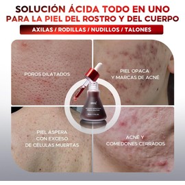 Sérum Exfoliante Facial 3 en 1 AHA BHA PHA – Solución Peeling con Ácido Glicólico y Ácido Salicílico, Ilumina la Piel, Minimiza Poros y Puntos Negros, Mejora la Textura, 30ml