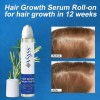 Vsyss Sérum Capilar Roll Crecimiento Romero Redensyl Tratamiento Anti Caída