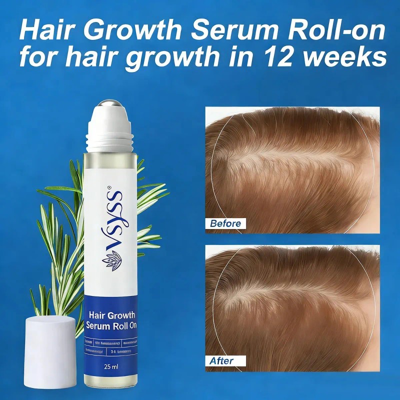 Vsyss Sérum Capilar Roll Crecimiento Romero Redensyl Tratamiento Anti Caída