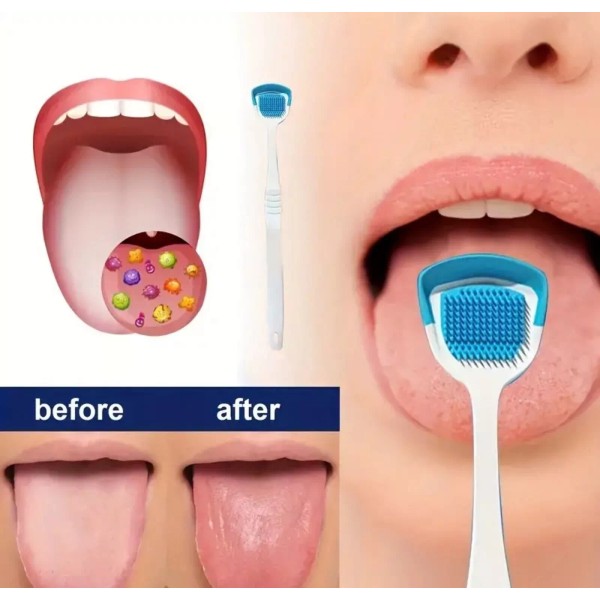 Unbranded Tongue Scraper Plaque Remover for Adults & Kids |