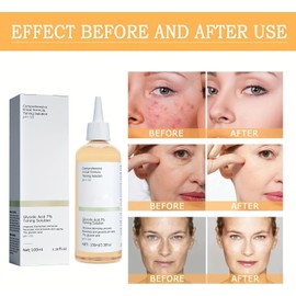 Glycolic Acid 7% Toning Serum – Hydrating & Exfoliating, Reduces Dullness, Refines Pores & Skin Texture, Minimises Fine Lines & Imperfections, 100ml