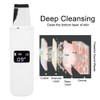 Ultrasonic Face Skin Scrubber Facial Cleanser Exfoliating Remove Blackheads Pimples