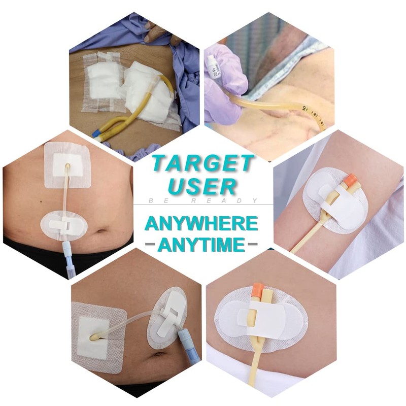 Peritoneal Dialysis PD Catheter Holder Adhesive Patch Stabilization Device for