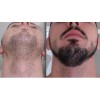 Crecer La Barba Bigote Cejas Profesional Y Natural Novocrin