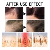Ampolletas Fortalecedoras De Cabello Anticada Caja 14pcs