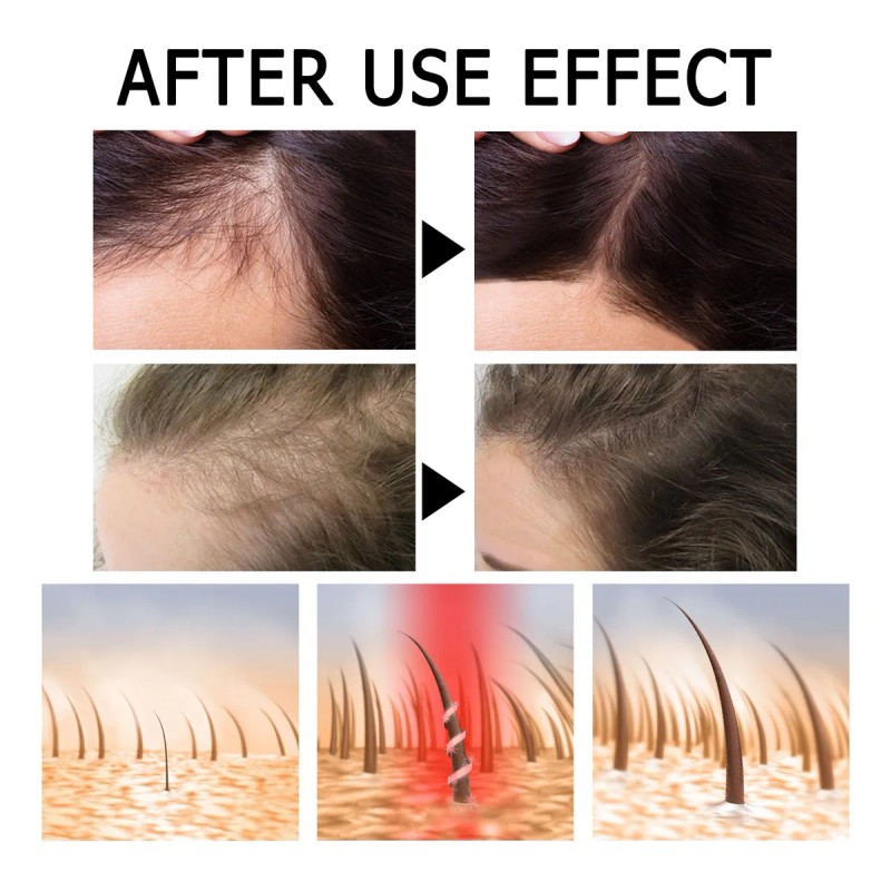 Ampolletas Fortalecedoras De Cabello Anticada Caja 14pcs