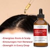 velona Hair Growth Formula - 4 oz | Castor, Amla,