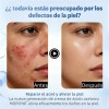 Ácido Azelaico Crema Con 20% Vitamina C Y Niacinamida