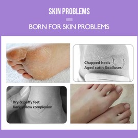 5 Pairs Lavender & Mint Foot Mask - Foot Moisturiser Socks Dry Feet - Cracked Heel Repair Treatment - Soothes,Exfoliates & Replenishes Feet - Foot Care for Women,Men,Teenager