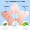 Pack de Parches para Acné AuraLux con Hidrocoloide y Ácido