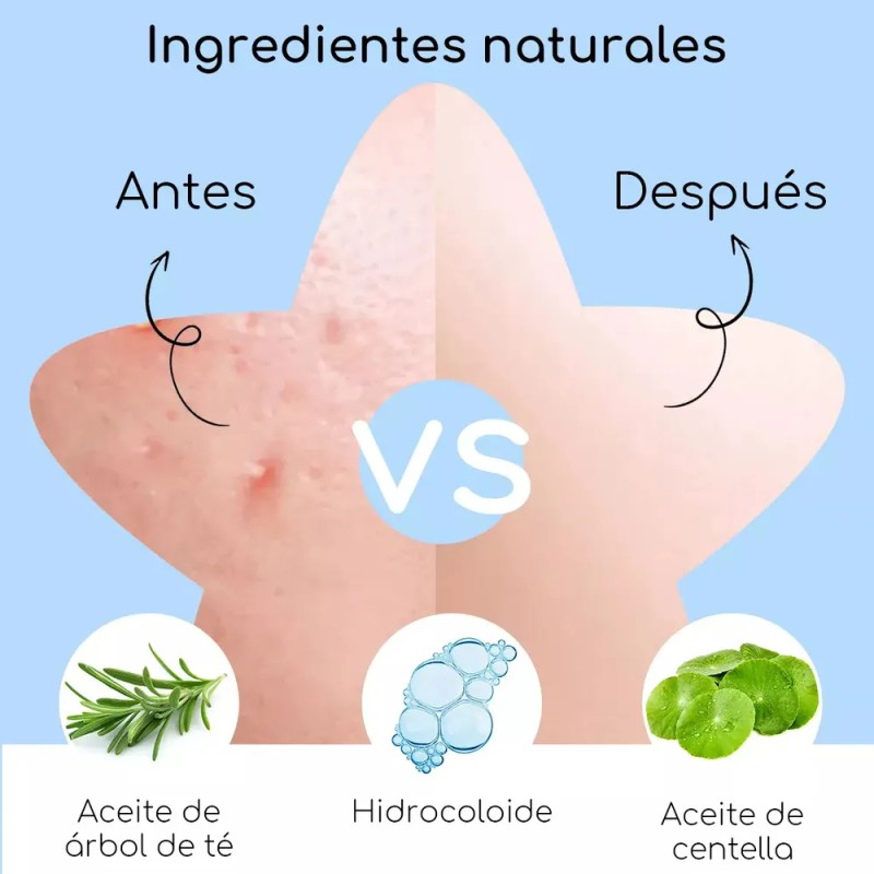 Pack de Parches para Acné AuraLux con Hidrocoloide y Ácido