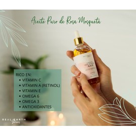 Rosehip Oil 100% Pure & Cold Pressed Healing, Anti-Stretch Marks, Anti-Wrinkle and Regenerating Oil for the Whole Body Even for Acne & Blemishes - Rosehip Oil (100 ml)