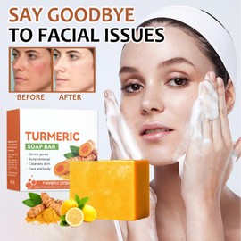 Kurkuma Aufhellende Seife,Turmeric Kojic Acid Soap,Turmeric Brightening Soap,Entfernen Sie Mitesser, Akne und Pickel aus dem Gesicht