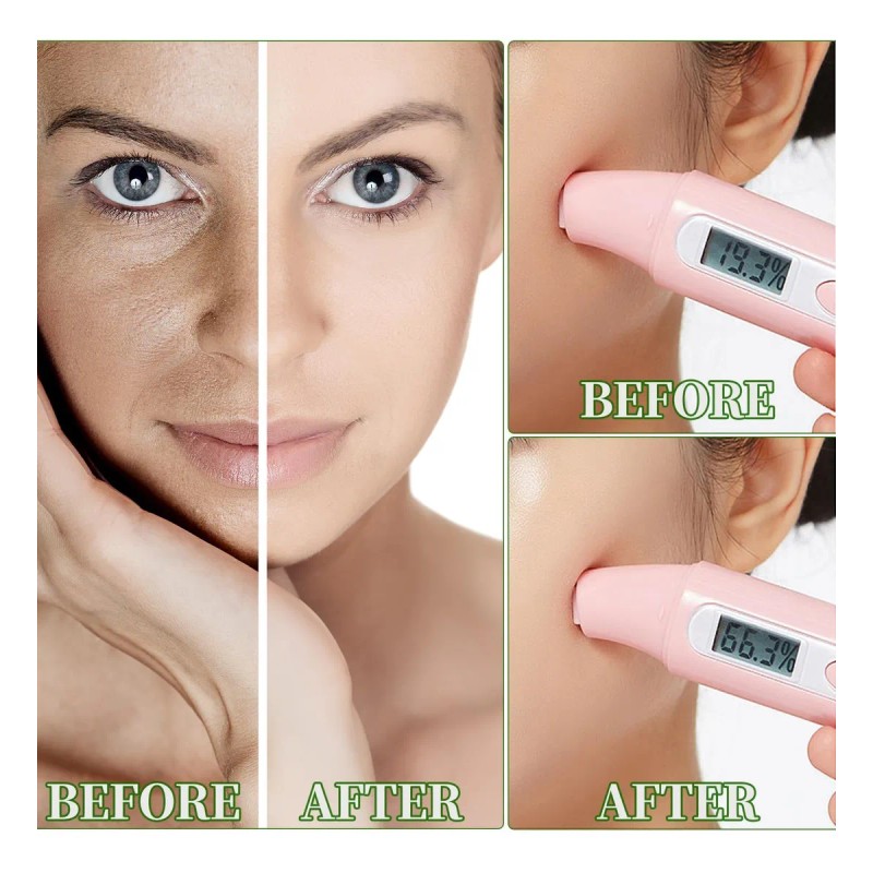 Mascarilla Facial De Aloe Vera, Mascarillas Hidratantes Para