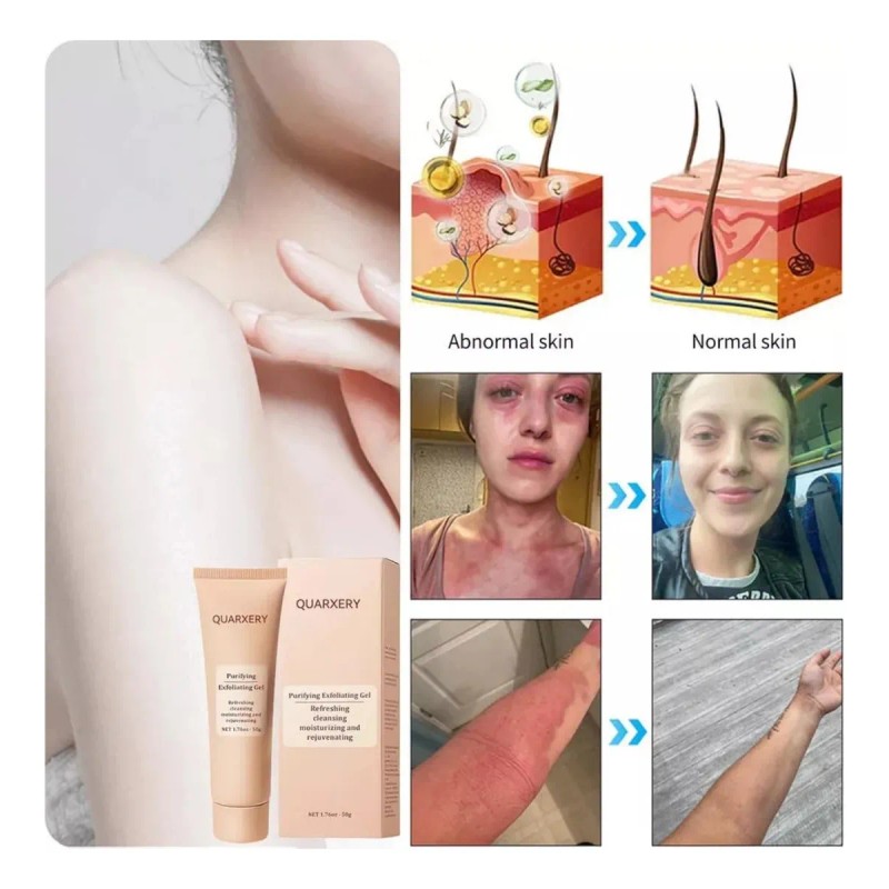 1pc Gel Exfoliante Purificante Quarxery, .