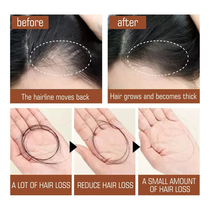 120 Ml Aceite De Crecimiento Del Cabello De Aceite De