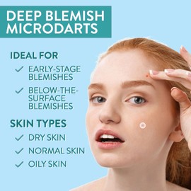 VILVIN Microdart Acne Patch - Zit Patches for Face - 27 ea - Fast Acting Blemish Cystic acne patches - Hyaluronic Acid, Tea Tree - Micropoint Pimple Patch