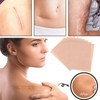 Invisible Scar Cover up Tape - Flaw Conceal Sticker,Cover up