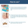 Toenail Patch, Toenail Correction Patch, Ingrown Toenails Correction Patch, Ingrown