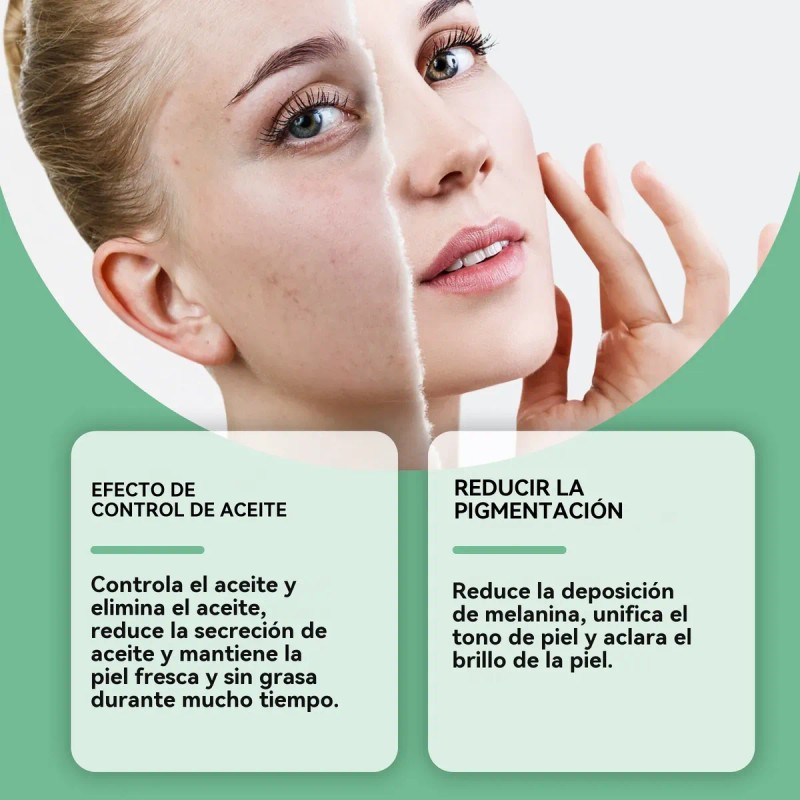 Creme De Ácido Azelaico Essência Facial 30g Anti-acne