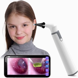 ScopeAround Wireless Otoscope Ear Camera with Dual View, 3.9Mm 720PHD Wifi Ear Scope 6 LED