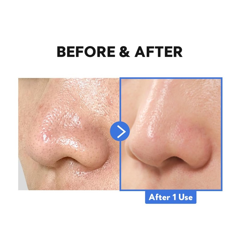 TIRTIR Hydro Boost Enzyme Cleansing Balm (1.69 Ounce (Pack of