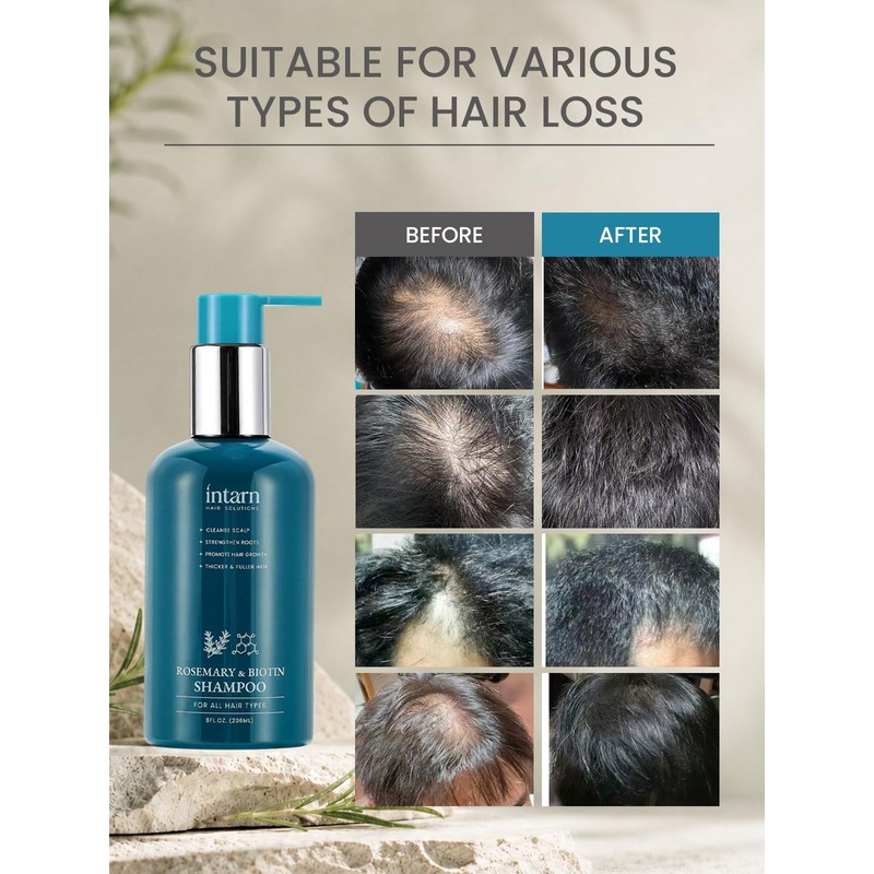 Biotin Rosemary Hair Growth Men Shampoo for Hair Loss 8