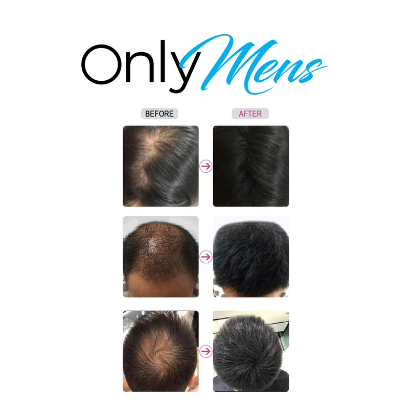 OnlyMens Hair Fibers (Light Brown)
