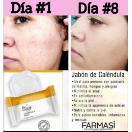 Jabón De Calendula/125 Grs/ Pieles Sensibles/ Farmasi